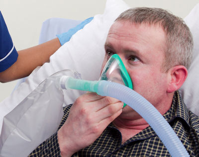 02/N20 breathing systems for free-flow applications