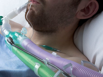 Silver Knight™ anti-microbial Flextube™ breathing systems