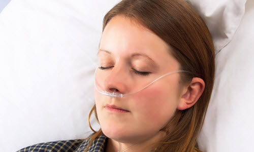 Sentri™ ETCO2 nasal cannulae